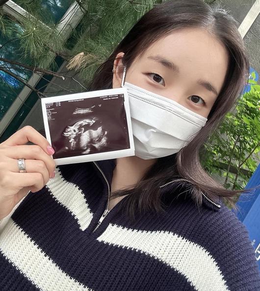 Baek A-yeon, 5 months pregnant, netizens congratulate her on joining 'Dragon Mom'... Expecting daughter 'Yongyongi'