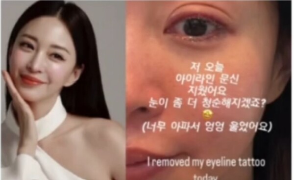 Han Ye-seul, after removing her eyeliner tattoo, 