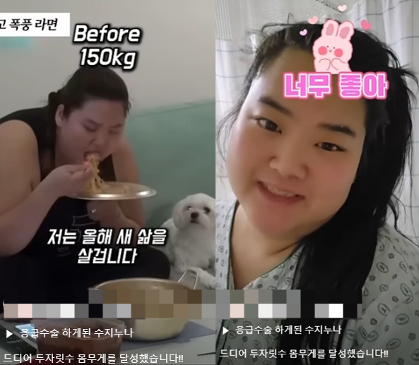 Mina's sister-in-law Park Soo-ji undergoes successful hernia surgery after losing 150kg → 99kg...