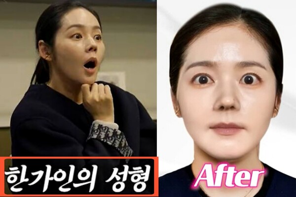 Han Ga-in, surprised by the “price of a car” after plastic surgery consultation, chooses natural aging